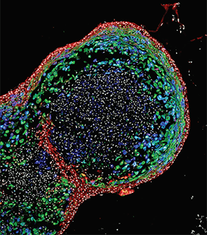 A confocal image of an esophageal organoid.